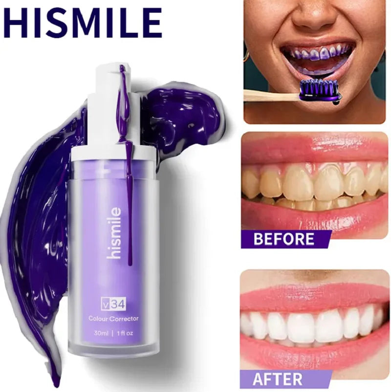 Hismile V34 Teeth Whitening Colour Corrector Serum 30ml