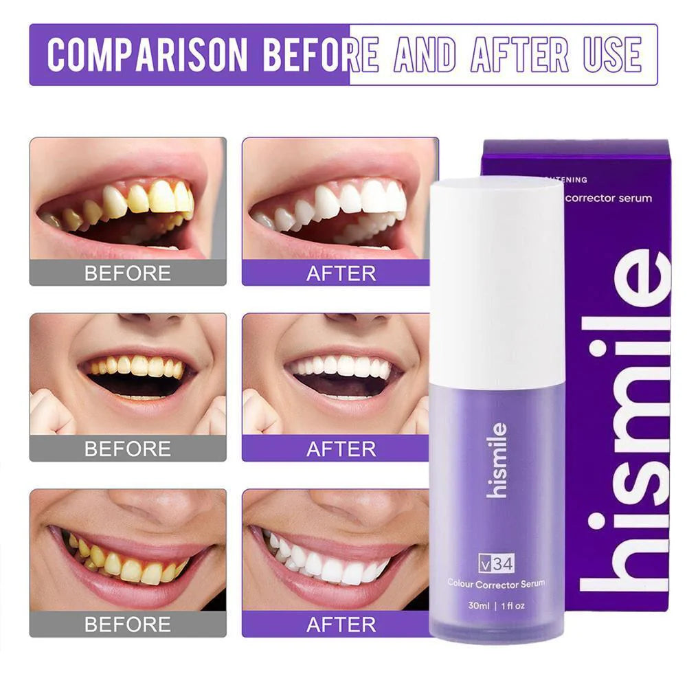 Hismile V34 Teeth Whitening Colour Corrector Serum 30ml