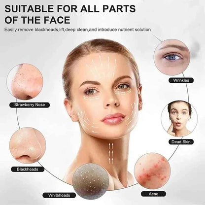 Ultrasonic Skin Scrubber for Deep Cleansing, Blackhead Extraction, and Facial Massaging - Exfoliator and Vibrating Face Cleaner with Ultrasonic Peeling