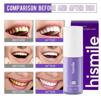 Hismile V34 Teeth Whitening Colour Corrector Serum 30ml
